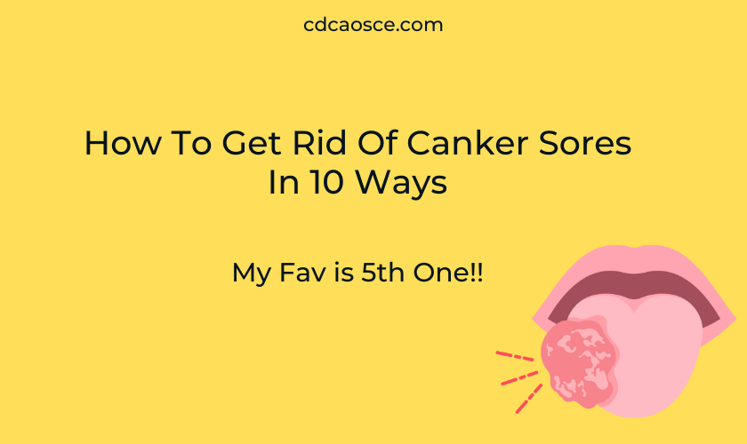 canker sores