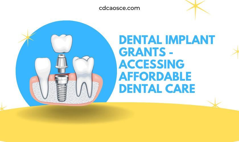 dental implant grants