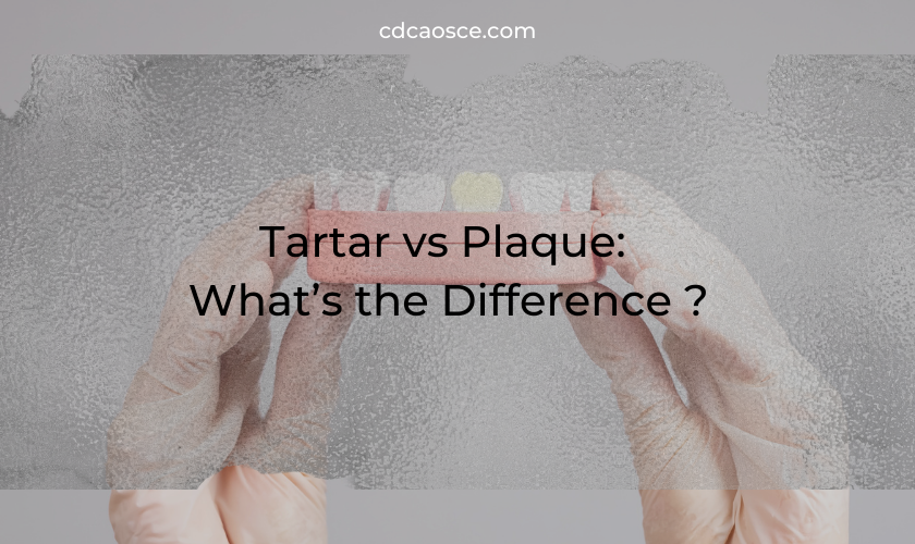 tartar vs plaque