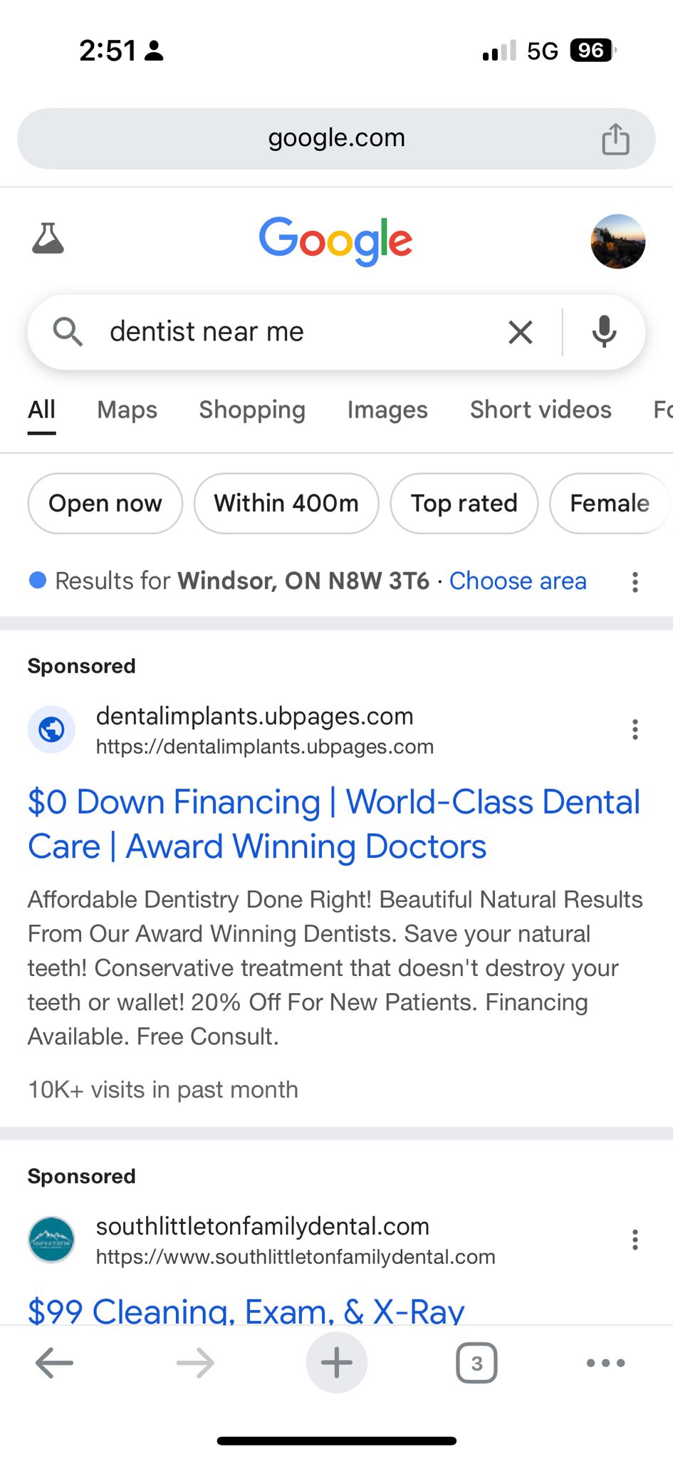 Real Google search for dentist near me in Windsor on a mobile device